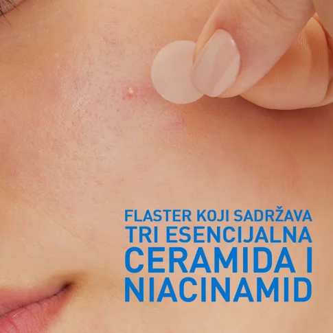 CeraVe Blemish Barrier flasteri protiv nepravilnosti 22 komada - Slika 2